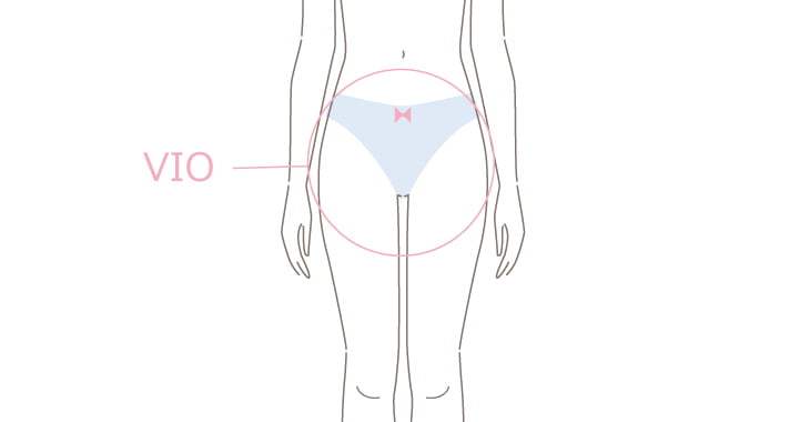VIO脱毛をするメリットと注意点