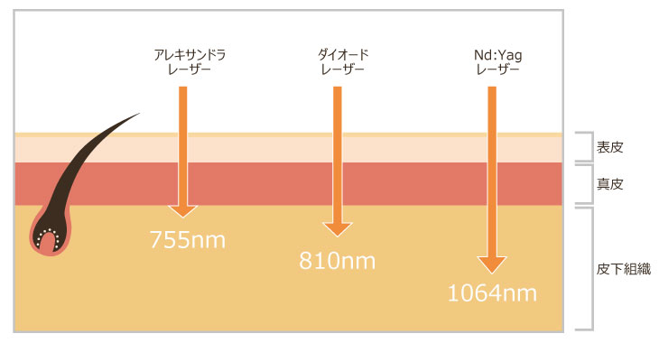 レーザーが届く幅が長い場合、広い面積を照射する分１回あたりの質量は弱くなります。