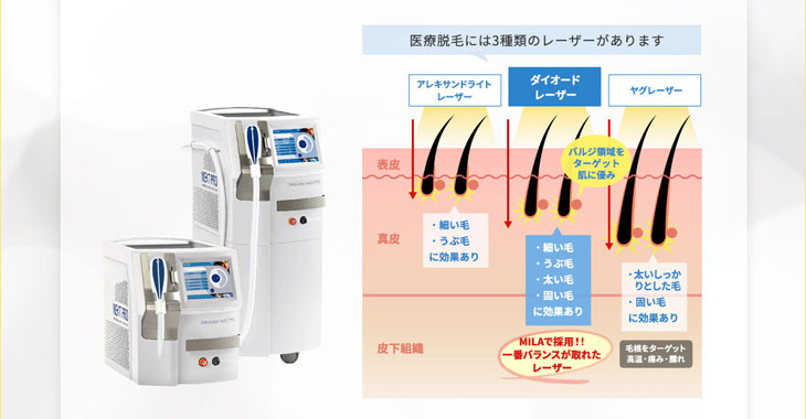 ダイオードレーザーの種類