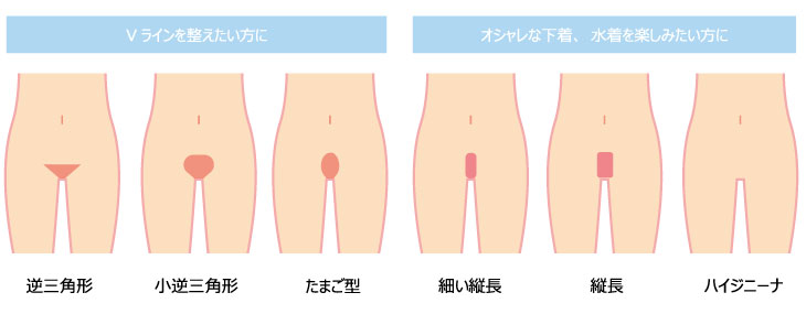 VIOの人気デザイン