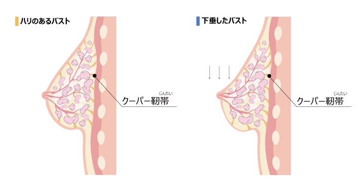 ナイトブラの効果