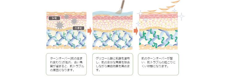 ケミカルピーリングの仕組み