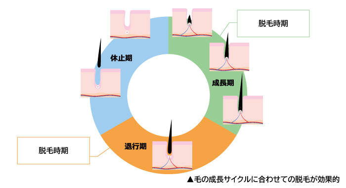 脱毛が1回で完了しない理由は毛の成長サイクルにある